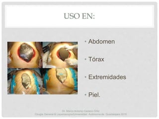 USO EN:
• Abdomen
• Tórax
• Extremidades
• Piel.
Dr. Marco Antonio Cedano Ortiz
Cirugía General & Laparoscopia/Universidad Autónoma de Guadalajara 2016
 