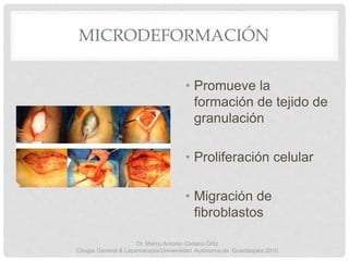 MICRODEFORMACIÓN
• Promueve la
formación de tejido de
granulación
• Proliferación celular
• Migración de
fibroblastos
Dr. Marco Antonio Cedano Ortiz
Cirugía General & Laparoscopia/Universidad Autónoma de Guadalajara 2016
 