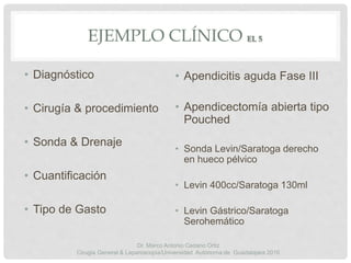 EJEMPLO CLÍNICO EL 5
• Apendicitis aguda Fase III
• Apendicectomía abierta tipo
Pouched
• Sonda Levin/Saratoga derecho
en hueco pélvico
• Levin 400cc/Saratoga 130ml
• Levin Gástrico/Saratoga
Serohemático
• Diagnóstico
• Cirugía & procedimiento
• Sonda & Drenaje
• Cuantificación
• Tipo de Gasto
Dr. Marco Antonio Cedano Ortiz
Cirugía General & Laparoscopia/Universidad Autónoma de Guadalajara 2016
 