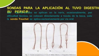 SONDAS PARA LA APLICACIÓN AL TUVO DIGESTIV
E
S
st
U
e P
tip
E
oR
de
IO
so
R
nd
:as se aplican en la nariz, ocasionalmente, por
dificultad técnica, se colocan directamente a través de la boca, solo
la sonda Fouchet se aplica exclusivamente por vía oral.
 