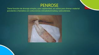 PENROSE
Tiene función de drenaje simple y por capilaridad, se utiliza para drenar material
purulento o hemático en colecciones intraabdominalesy subcutáneas.
 