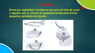 FILIFORME
Drena por capilaridad. Consiste en una serie de hilos de nylon
o algodón que se colocan en pequeñas heridas para drenar
pequeñas cantidades de líquido.
 
