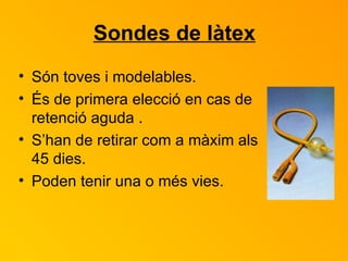 Sondes de làtex Són toves i modelables.  És de primera elecció en cas de retenció aguda . S’han de retirar com a màxim als 45 dies. Poden tenir una o més vies. 