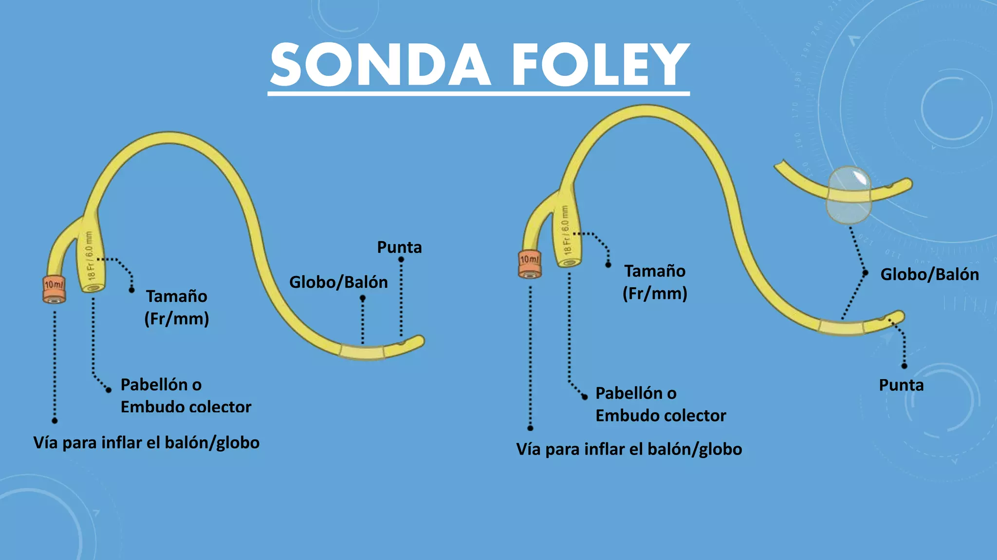 Colocación de sonda Foley en hombre y mujer (Sondaje Vesical) | PPTX