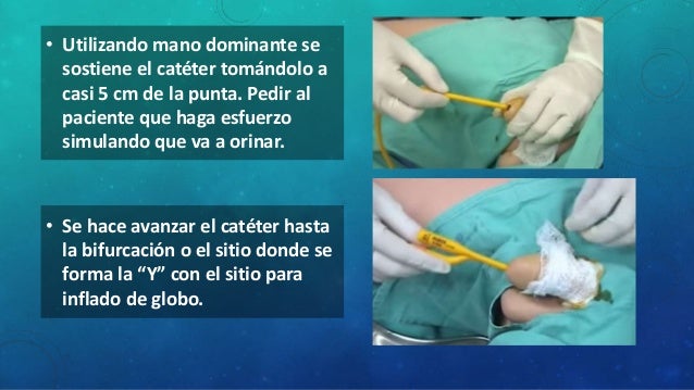 Continencia Coloplast Continencia Coloplast