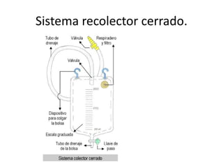 Sistema recolector cerrado.
 