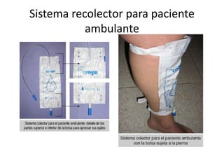 Sistema recolector para paciente
ambulante
 