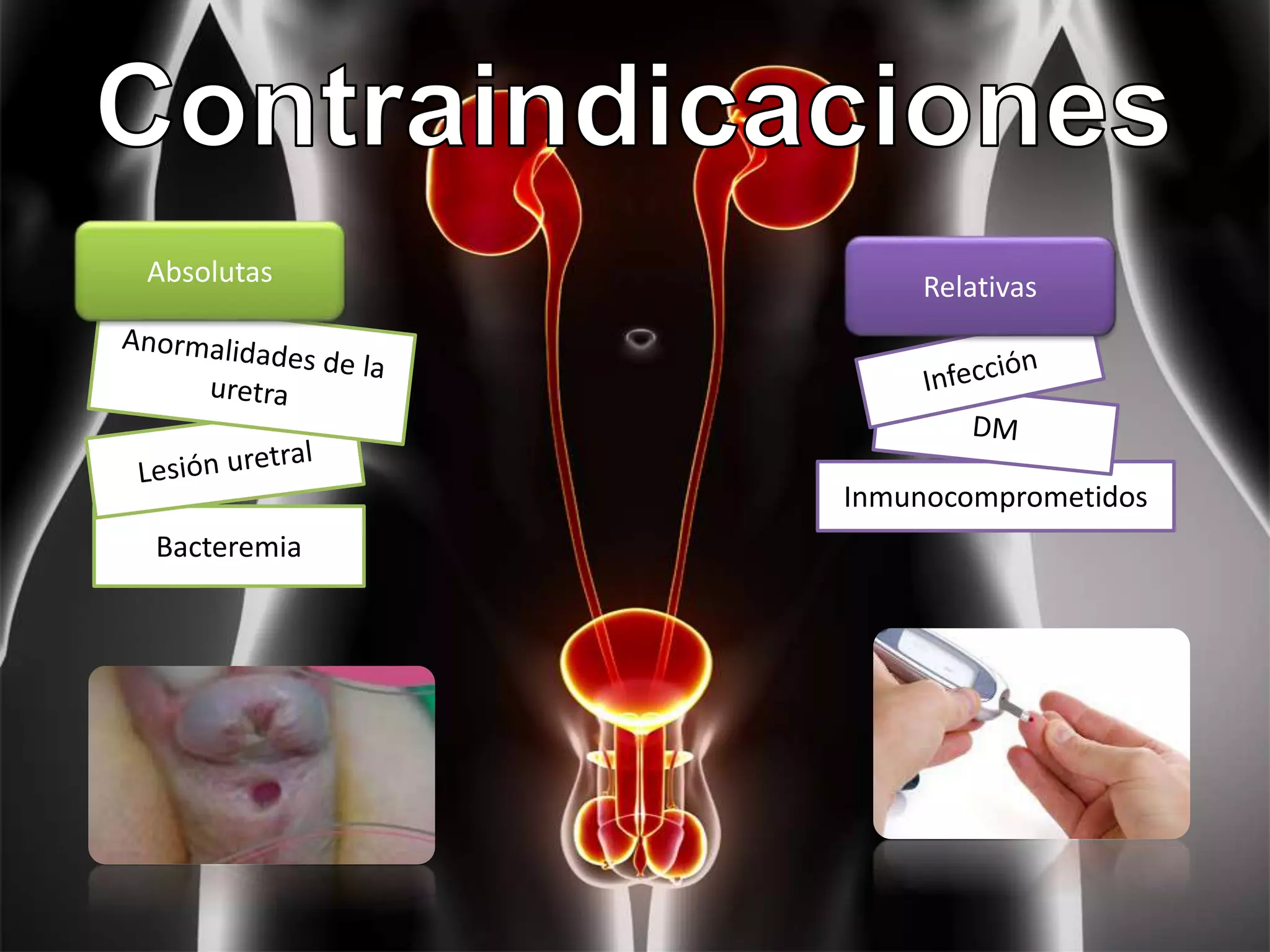 Inmunocomprometidos
Bacteremia
Absolutas Relativas