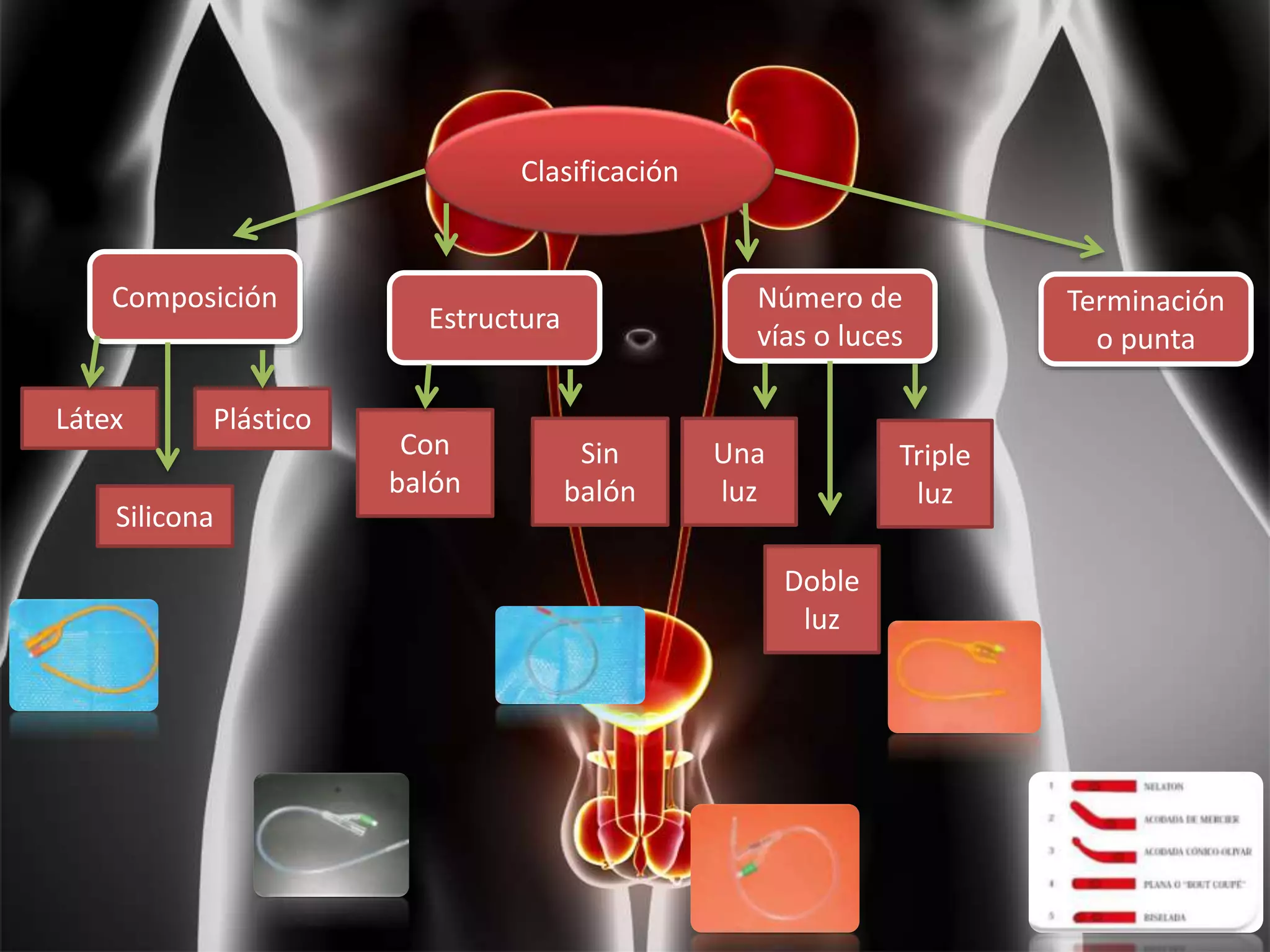 Clasificación
Composición
Látex
Silicona
Plástico
Estructura
Con
balón
Sin
balón
Número de
vías o luces
Una
luz
Doble
luz
Triple
luz
Terminación
o punta