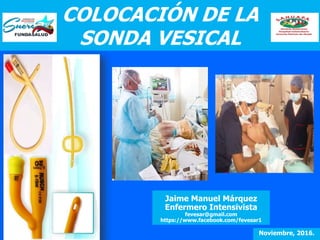 COLOCACIÓN DE LA
SONDA VESICAL
ÑÑ
Jaime Manuel Márquez
Enfermero Intensivista
fevesar@gmail.com
https://www.facebook.com/fevesar1
Noviembre, 2016.
 