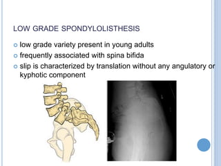LOW GRADE SPONDYLOLISTHESIS
 low grade variety present in young adults
 frequently associated with spina bifida
 slip is characterized by translation without any angulatory or
kyphotic component
 