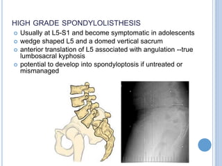 HIGH GRADE SPONDYLOLISTHESIS
 Usually at L5-S1 and become symptomatic in adolescents
 wedge shaped L5 and a domed vertical sacrum
 anterior translation of L5 associated with angulation --true
lumbosacral kyphosis
 potential to develop into spondyloptosis if untreated or
mismanaged
 