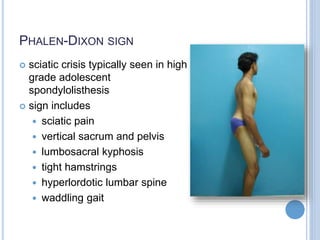 PHALEN-DIXON SIGN
 sciatic crisis typically seen in high
grade adolescent
spondylolisthesis
 sign includes
 sciatic pain
 vertical sacrum and pelvis
 lumbosacral kyphosis
 tight hamstrings
 hyperlordotic lumbar spine
 waddling gait
 