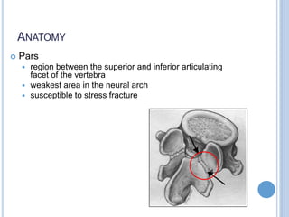 ANATOMY
 Pars
 region between the superior and inferior articulating
facet of the vertebra
 weakest area in the neural arch
 susceptible to stress fracture
 
