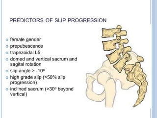 PREDICTORS OF SLIP PROGRESSION
 female gender
 prepubescence
 trapezoidal L5
 domed and vertical sacrum and
sagital rotation
 slip angle > -10o
 high grade slip (>50% slip
progression)
 inclined sacrum (>30o beyond
vertical)
 