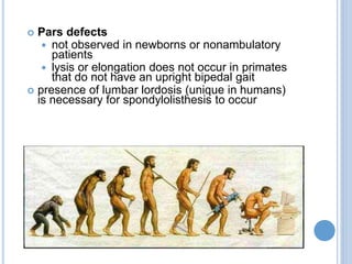  Pars defects
 not observed in newborns or nonambulatory
patients
 lysis or elongation does not occur in primates
that do not have an upright bipedal gait
 presence of lumbar lordosis (unique in humans)
is necessary for spondylolisthesis to occur
 