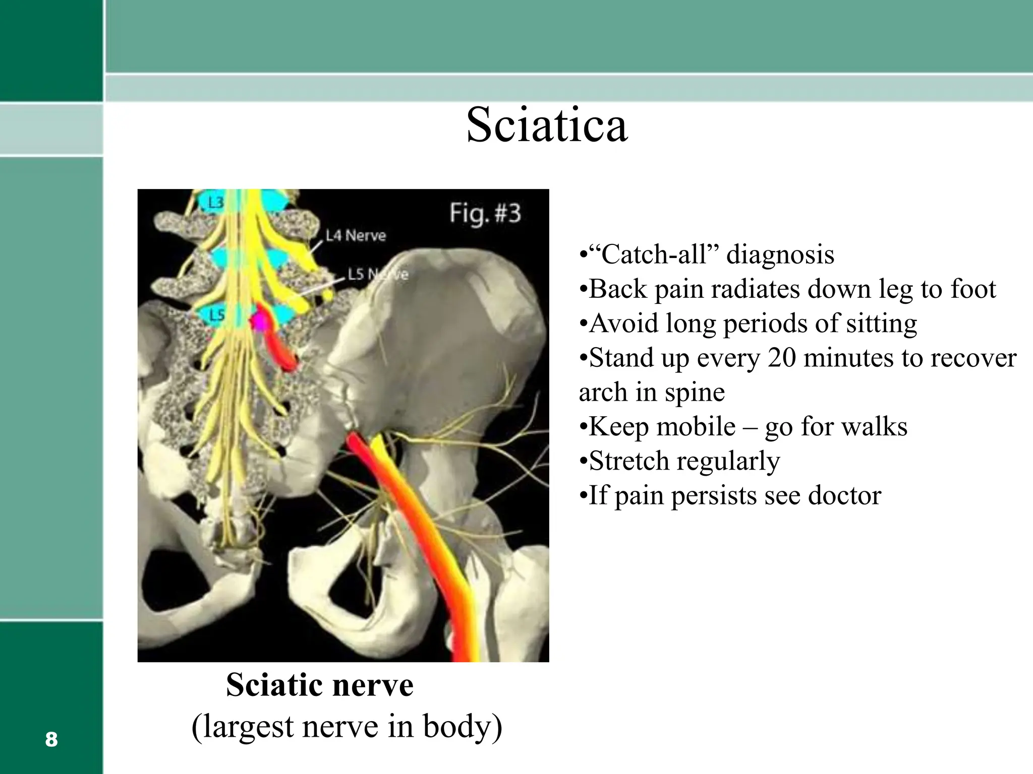 8
Sciatica
Sciatic nerve
(largest nerve in body)
•“Catch-all” diagnosis
•Back pain radiates down leg to foot
•Avoid long periods of sitting
•Stand up every 20 minutes to recover
arch in spine
•Keep mobile – go for walks
•Stretch regularly
•If pain persists see doctor
 