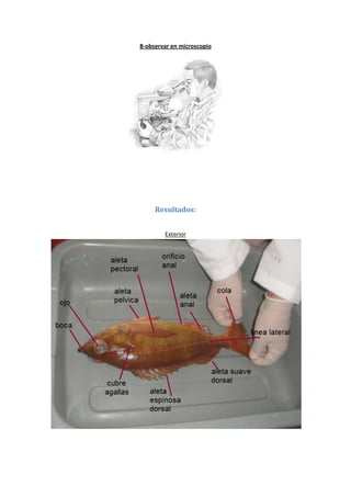 8-observar en microscopio




     Resultados:


        Exterior
 