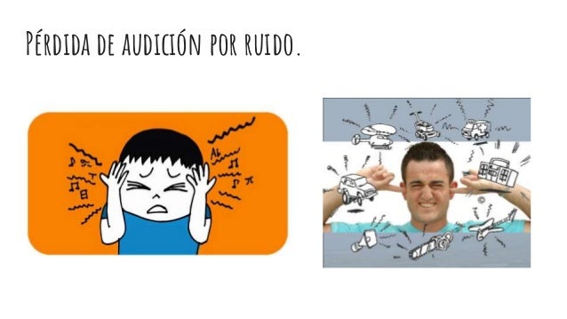 sis audición sis audición