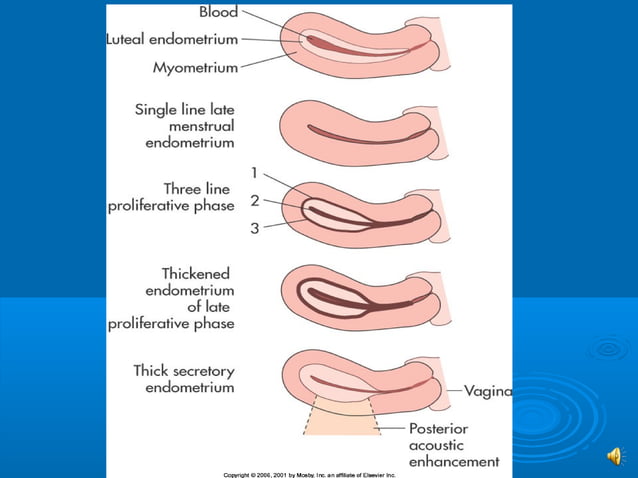 Sono 202 normal gyn anatomy | PPT
