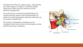 sonoanatomy of spine anaesthesia pov ppt. | PPTX