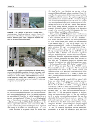 Sonodynamic and photodynamic therapy in advanced breast carcinoma: a ...