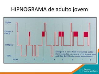 HIPNOGRAMA de adulto jovem
 