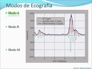 Modos de Ecografía
Dario A. Adames Acosta
 