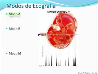 Modos de Ecografía
Dario A. Adames Acosta
 