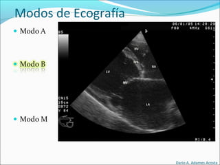 Modos de Ecografía
Dario A. Adames Acosta
 