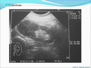 Convexas
Dario A. Adames Acosta
 