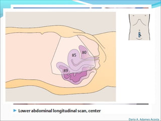 Dario A. Adames Acosta
 