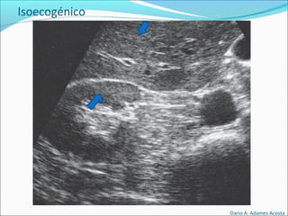 Isoecogénico
Dario A. Adames Acosta
 
