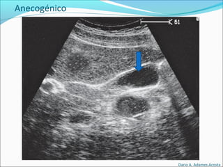 Anecogénico
Dario A. Adames Acosta
 