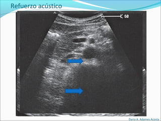 Refuerzo acústico
Dario A. Adames Acosta
 