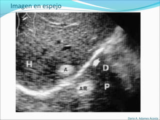 Imagen en espejo
Dario A. Adames Acosta
 