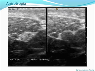 Anisotropía
Dario A. Adames Acosta
 