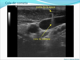 Cola de cometa
Dario A. Adames Acosta
 