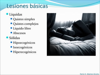 Lesiones básicas
Líquidas
Quistes simples
Quistes complejos
Líquido libre
Abscesos
Sólidas
Hipoecogénicos
Isoecogénicos
Hiperecogénicos
Dario A. Adames Acosta
 