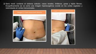  Seno renal: contiene el sistema colector, vasos renales, linfáticos, grasa y tejido fibroso.
Ecográficamente se ve como una imagen hiperecogénica ovoide en los cortes sagitales y
redondeada en cortes transversales.
 