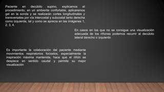 Paciente en decúbito supino, explicamos el
procedimiento, en un ambiente confortable, aplicaremos
gel en la sonda y se realizarán cortes longitudinales y
transversales por vía intercostal y subcostal tanto derecha
como izquierda, tal y como se aprecia en las imágenes 1,
2, 3, 4.
En casos en los que no se consigue una visualización
adecuada de los riñones podemos recurrir al decúbito
lateral derecho o izquierdo
Es importante la colaboración del paciente mediante
movimientos respiratorios forzados, especialmente la
inspiración máxima mantenida, hace que el riñón se
desplace en sentido caudal y permite su mejor
visualización
 