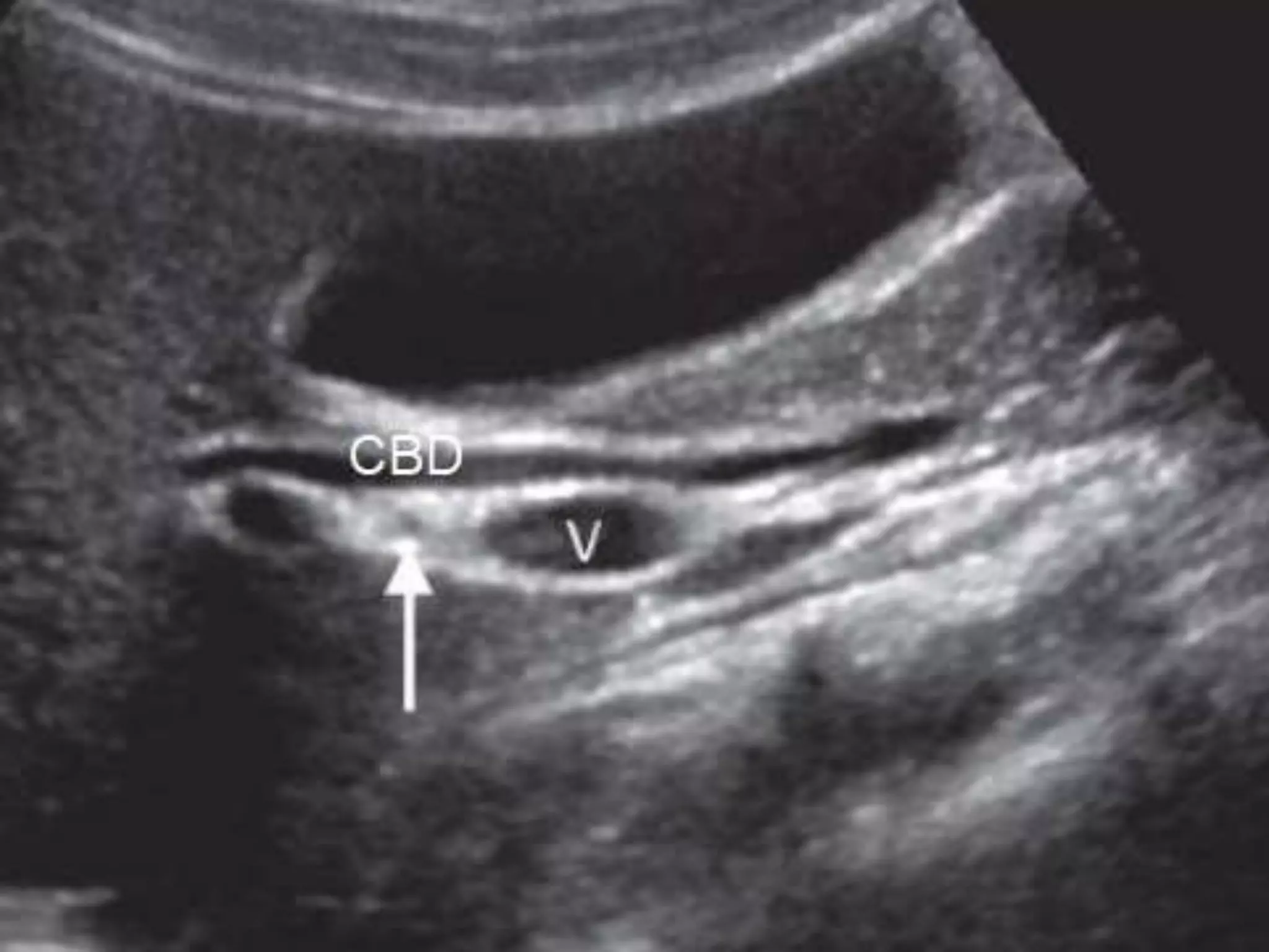 Sonographic anatomy of abdomen and pelvic organ | PPTX