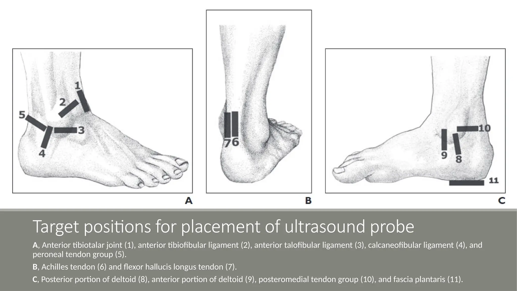 Sonography of the Normal Ankle - A Target Approach Using Skeletal ...