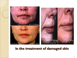in the treatment of damaged skin

                                   40
 