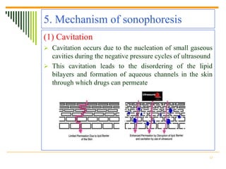 5. Mechanism of sonophoresis
(1) Cavitation
 Cavitation occurs due to the nucleation of small gaseous
  cavities during the negative pressure cycles of ultrasound
 This cavitation leads to the disordering of the lipid
  bilayers and formation of aqueous channels in the skin
  through which drugs can permeate




                                                          12
 
