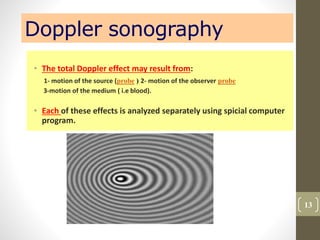 Doppler sonography
• The total Doppler effect may result from:
1- motion of the source (probe ) 2- motion of the observer probe
3-motion of the medium ( i.e blood).
• Each of these effects is analyzed separately using spicial computer
program.
13
 
