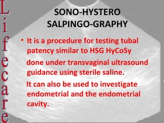Sonosalpingography. Dr. Sharda Jain, Dr. Jyoti Agarwal | PPT