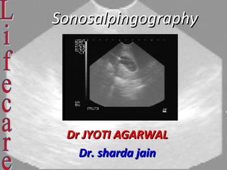 SonosalpingographySonosalpingography
Dr JYOTI AGARWALDr JYOTI AGARWAL
Dr. sharda jainDr. sharda jain
 