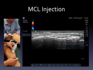 Ultrasound Guided Injections - Lower Extremity | PDF