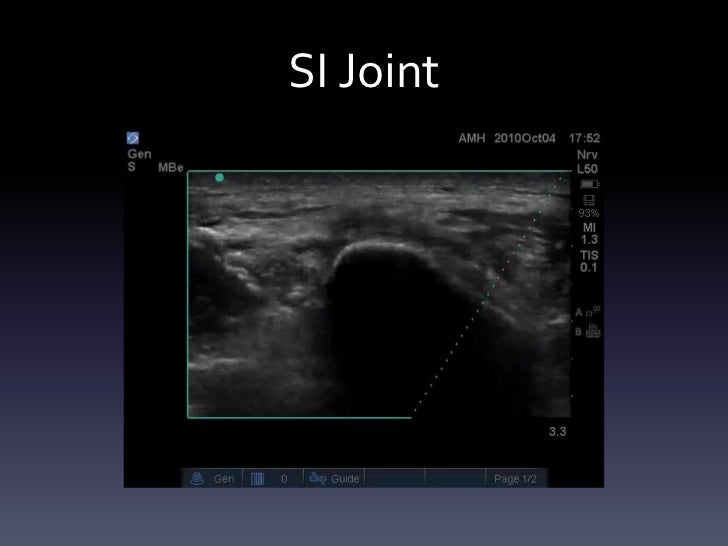 ultrasound injections extremity hematoma